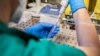 Crna Gora traži ljekare i medicinsko osoblje, EU proslijedila zahtjev članicama