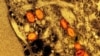 Thailand says mpox case recorded in traveler from Africa 