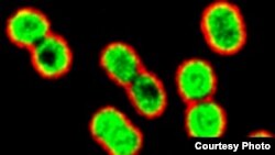 Bakteri Acinetobacter baumannii dimatikan oleh azithromycin (hijau). (Foto: UC-San Diego School of Medicine)