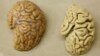 تغییر تعریف بیماری آلزایمر با هدف تشخیص زودهنگام آن 