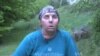 Face Transplant Recipient Gets New Lease on Life