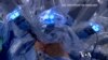 Training Surgeons to Perform Robotic Surgery
